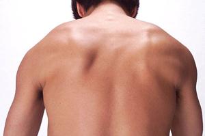 天神でたるみ予防目的の糸リフト